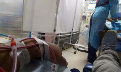 Pacientes en diálisis bfe 7f4f32b8d0e4