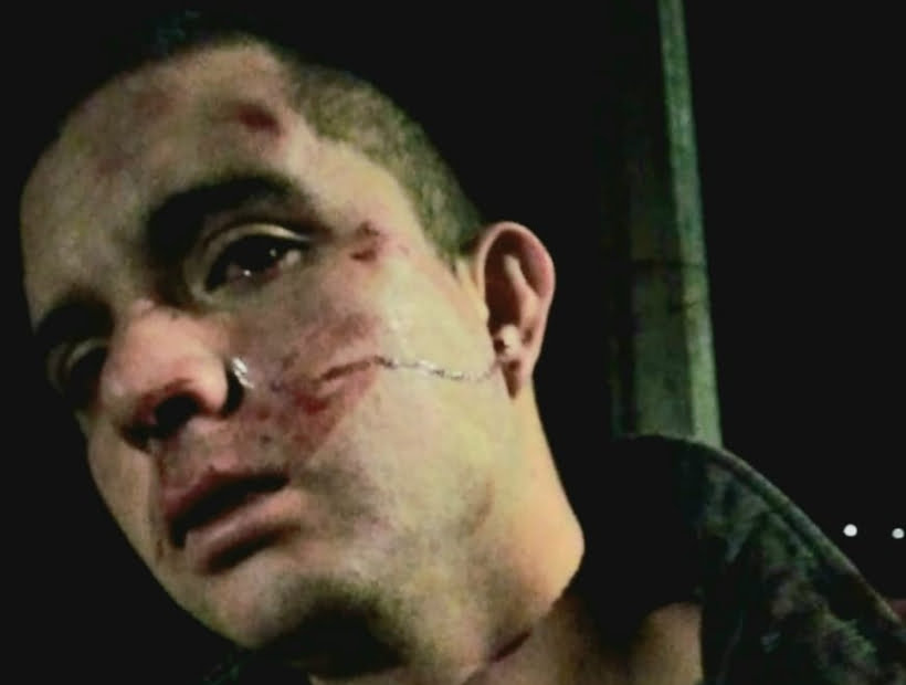 Brutal golpiza de a hombre en Quintero c 505b9