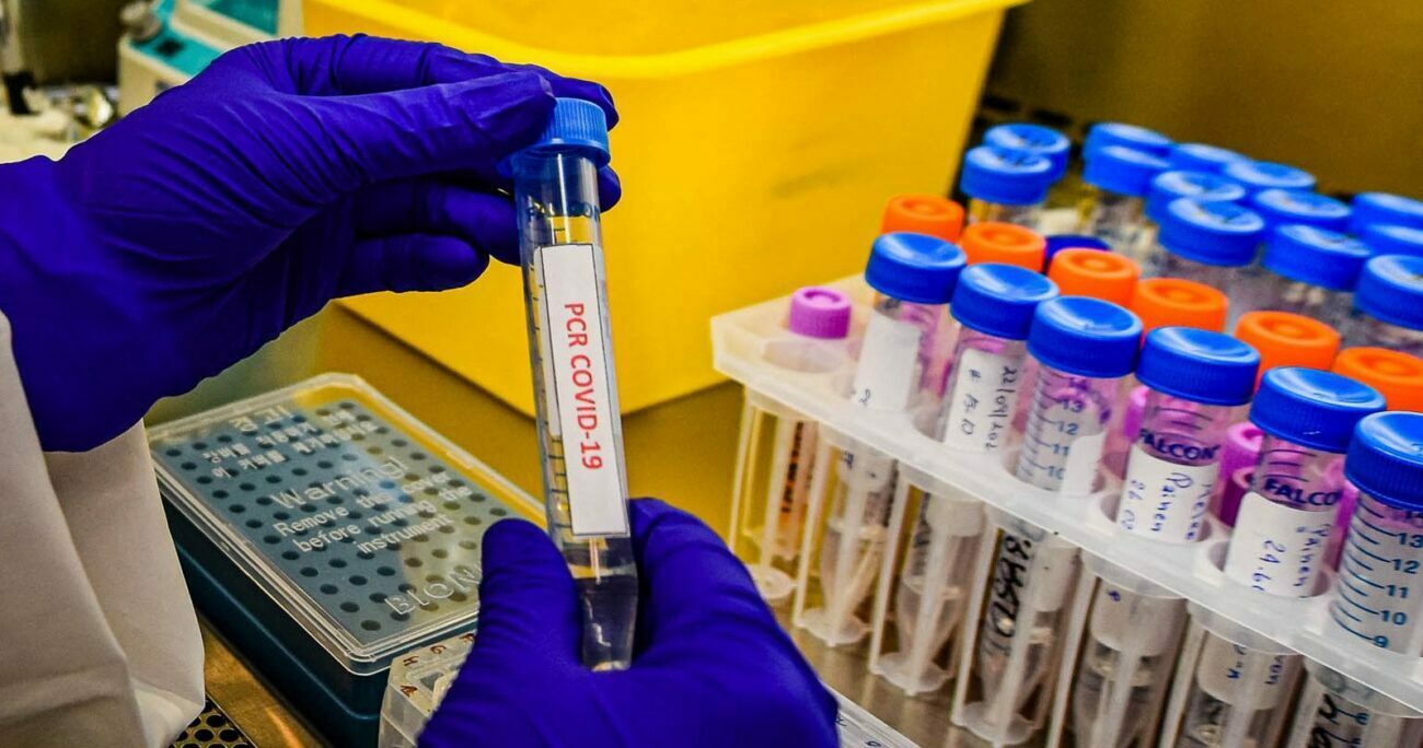TEMUCO: PCR del Laboratorio del Hospital Andrés San Martín